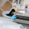 Fiocruz obtém patente para tratamento contra malária resistente
