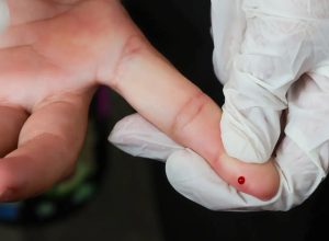 sus-passa-a-oferecer-teste-rapido-de-dengue