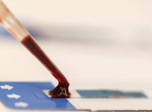 estudo-inedito-da-fiocruz-pode-ampliar-prevencao-de-hiv-entre-jovens