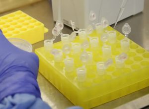 sp-confirma-segundo-caso-importado-de-sarampo